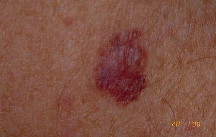 pinpoint red spot on skin