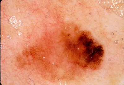 Neotoma Skin Research | Medical | Skin | NYU Dataset